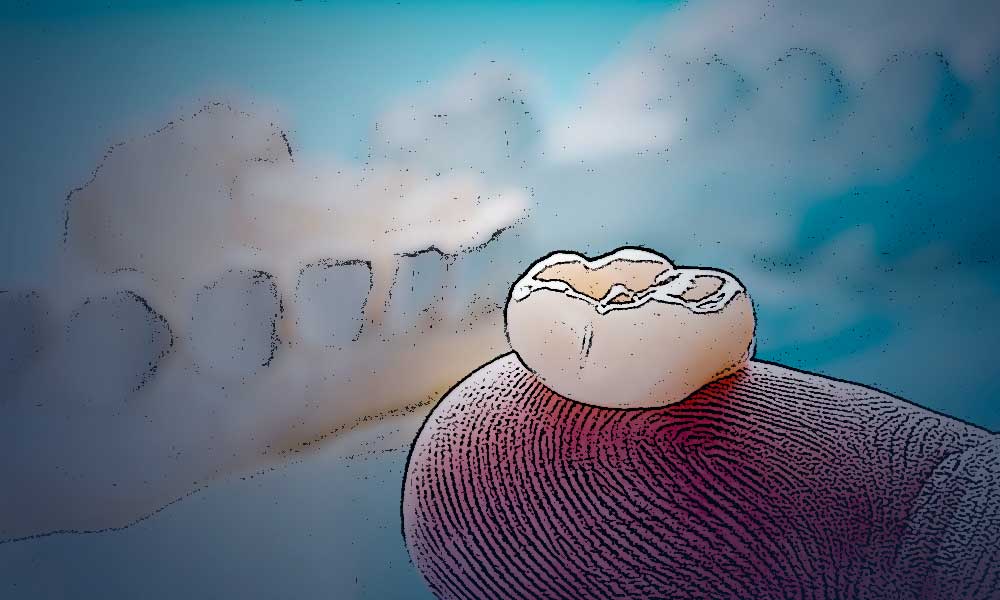 установка коронки зубов